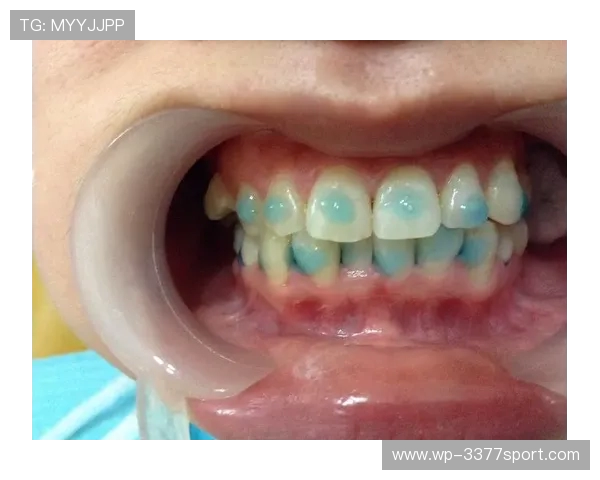 修补过的大门牙玩家挑战游戏高难度关卡，一边玩一边展示牙齿修复过程